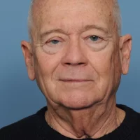 1621436998 new 1 before