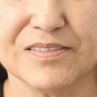 1675980806-19a-before