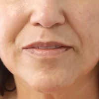 1675980835-19a-zafter