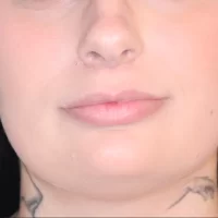 1675981113-23a-before