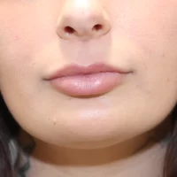 1675981120-23a-zafter