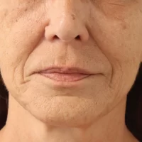 1675981380-25a-before