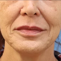 1675981388-25a-zafter