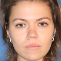 1678210352-7a-before