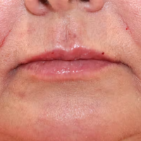 1687545843-7a-zafter