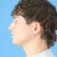 1699559977 4a before