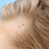 1699560351-13a-before