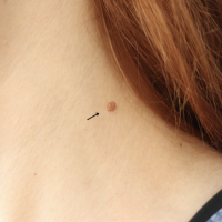 1699564005-14a-before