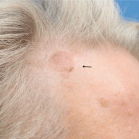 1699564173-15a-before