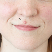 1699564248-17a-before