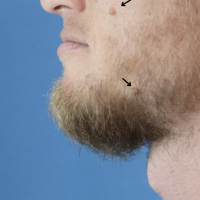 1710959172-18-before