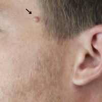 1710959288-19-before