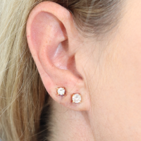 Earlobe-reduction-22a-zafter