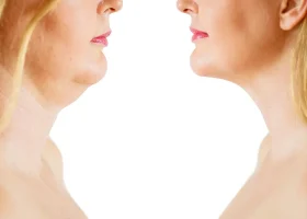 Say Good-bye to Your “Turkey Gobbler” by the Holidays!